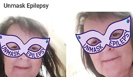 My UnMask Epilepsy Austrailia Campaign Photo Mask - 2021